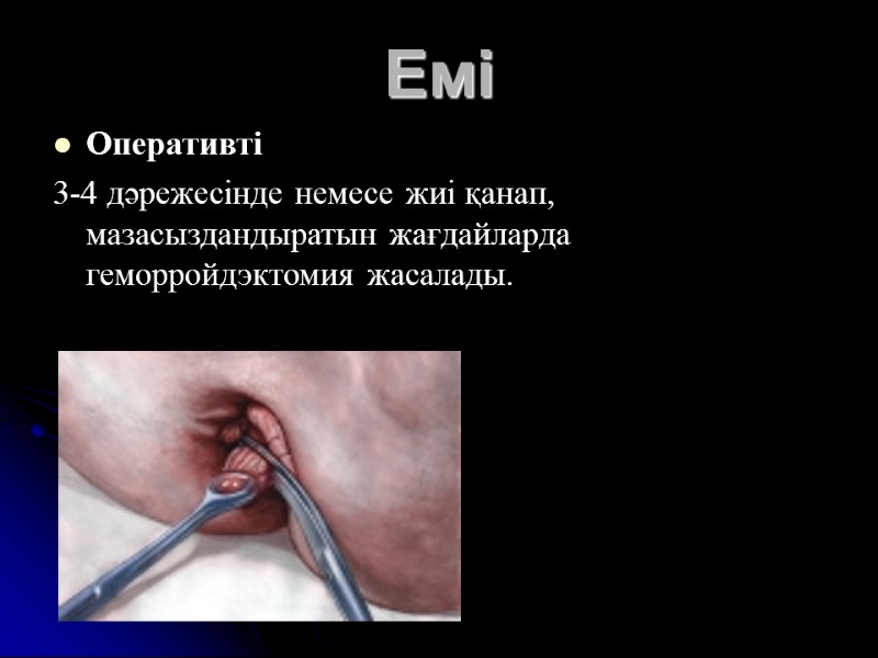 Емі Оперативті  3-4 дәрежесінде немесе жиі қанап, мазасыздандыратын жағдайларда геморройдэктомия жасалады.